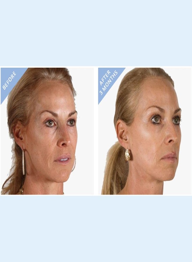 stemulation HI Impact Serum - The Ultimate Brightening Serum with Hyaluronic Acid, Vitamin C and Epidermal Growth Factors - Image 5